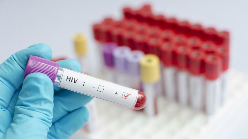 La ciencia exonera finalmente al paciente cero del VIH