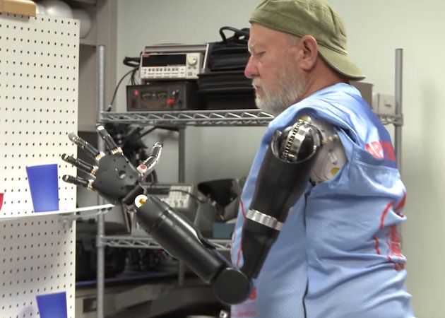 Amputado de ambos brazos manejando brazos roboticós