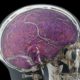 Especial: Diez grandes mitos sobre el cerebro humano 39