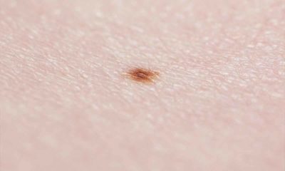 Google quiere ser tu dermatólogo