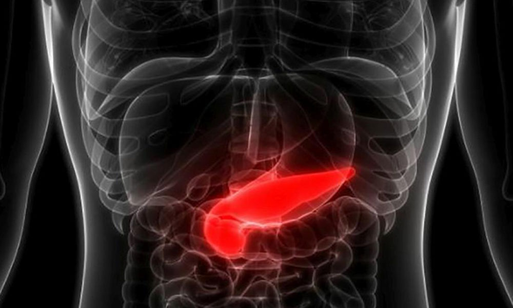 descubren un biomarcador que detecta el cáncer de páncreas precoz