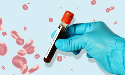 detección de un cáncer