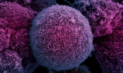 células cancerosas
